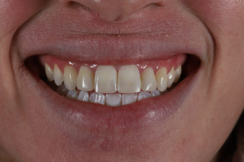 After - Cheadle Hulme Dental