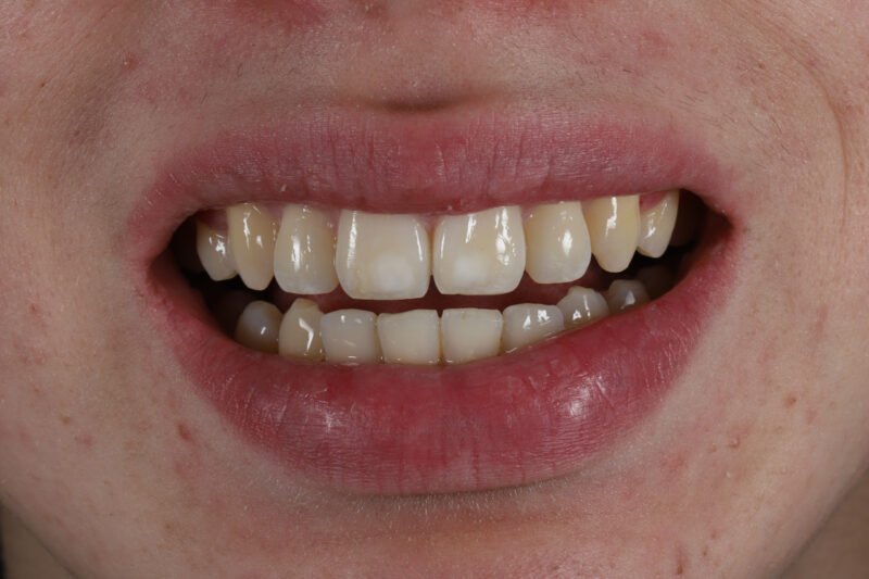 After - Cheadle Hulme Dental