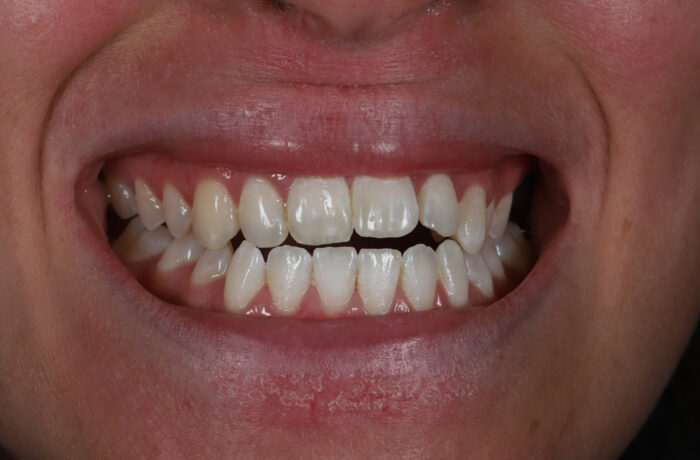 Before - Cheadle Hulme Dental