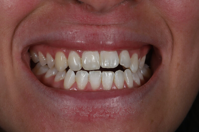 Before - Cheadle Hulme Dental