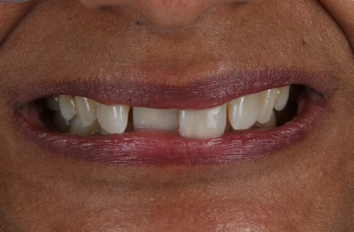 Before - Cheadle Hulme Dental