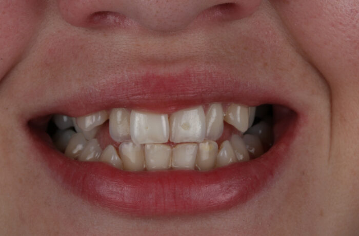 Before - Cheadle Hulme Dental