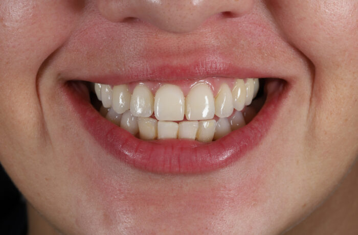 After - Cheadle Hulme Dental