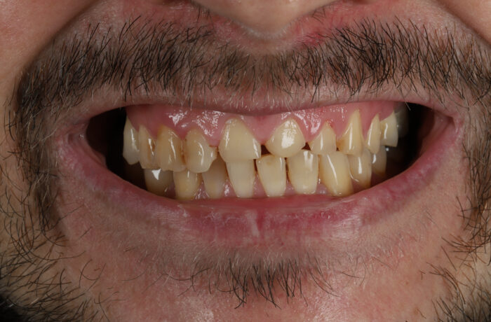 Before - Cheadle Hulme Dental