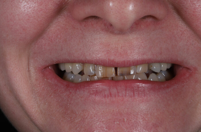 Before - Cheadle Hulme Dental