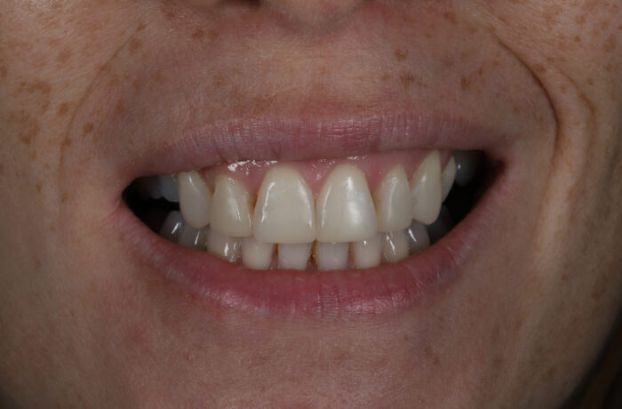 After - Cheadle Hulme Dental