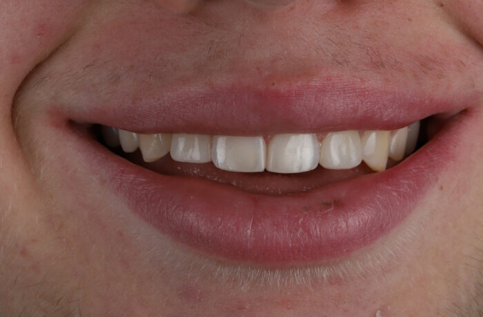 After - Cheadle Hulme Dental