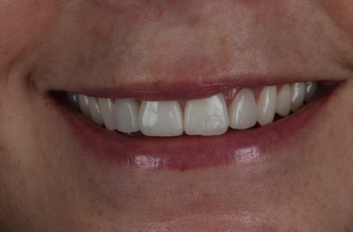 After - Cheadle Hulme Dental