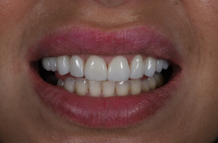 After - Cheadle Hulme Dental