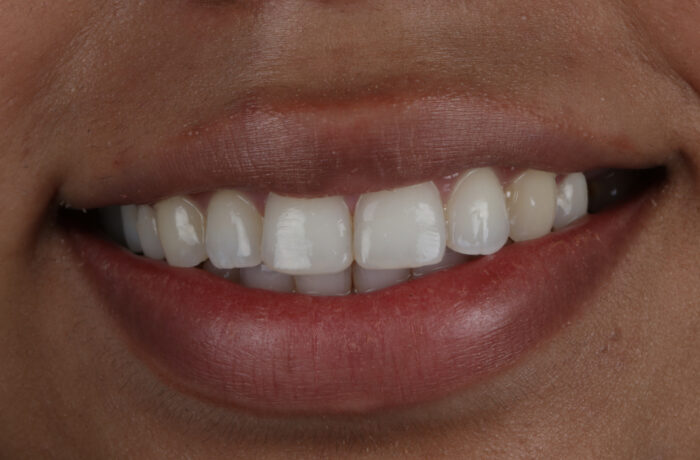 After - Cheadle Hulme Dental