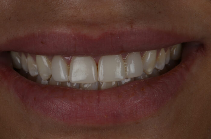 After - Cheadle Hulme Dental