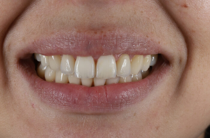 After - Cheadle Hulme Dental