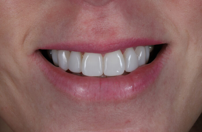 After - Cheadle Hulme Dental