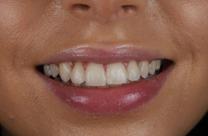 After - Cheadle Hulme Dental