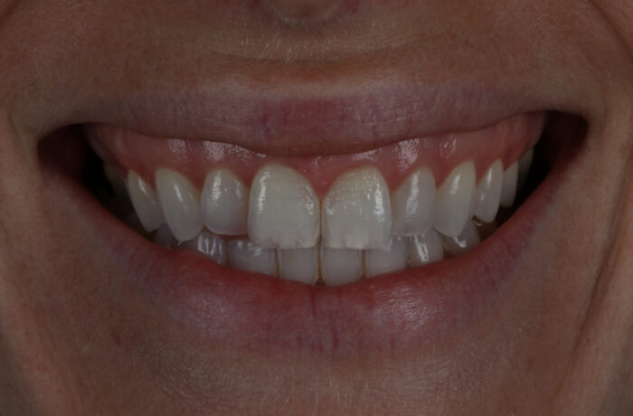 Before - Cheadle Hulme Dental