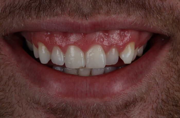 Before - Cheadle Hulme Dental