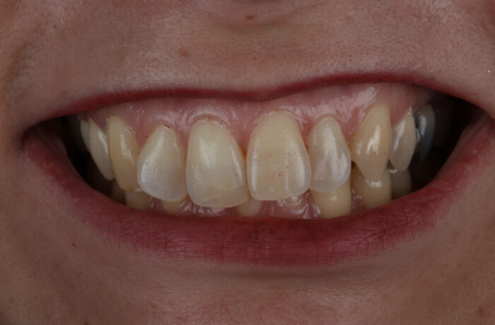 Before - Cheadle Hulme Dental