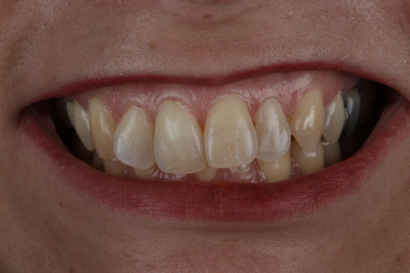 Before - Cheadle Hulme Dental