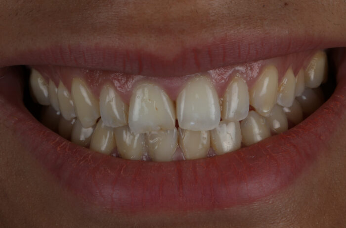 Before - Cheadle Hulme Dental