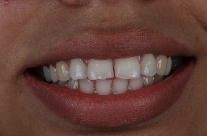 Before - Cheadle Hulme Dental