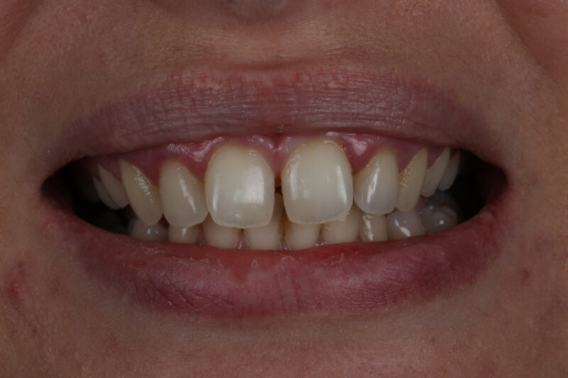 Before - Cheadle Hulme Dental