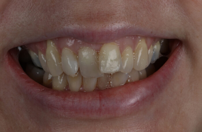 Before - Cheadle Hulme Dental