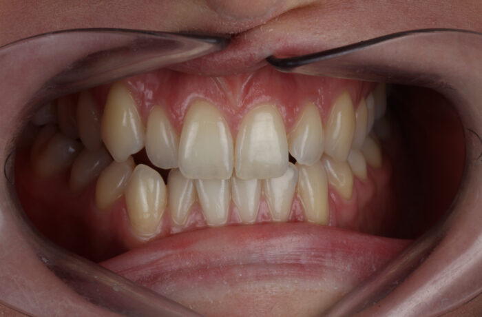 Before - Cheadle Hulme Dental