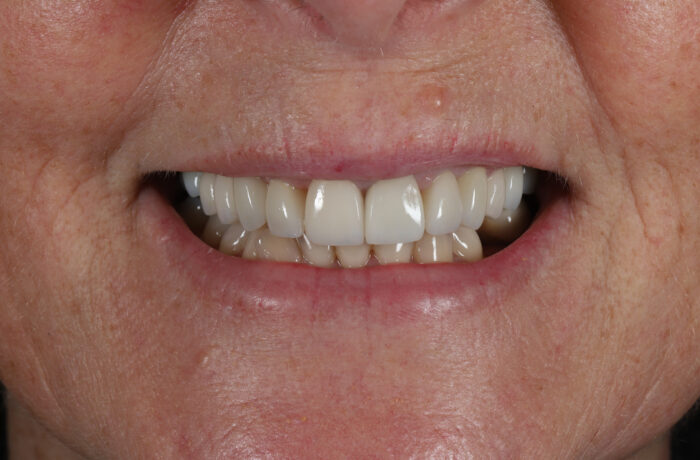 After - Cheadle Hulme Dental