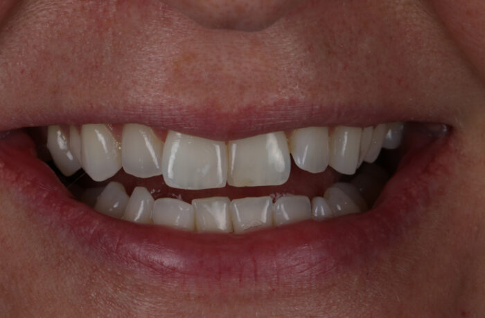 Before - Cheadle Hulme Dental