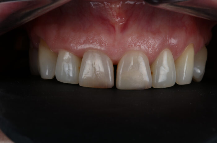 Before - Cheadle Hulme Dental