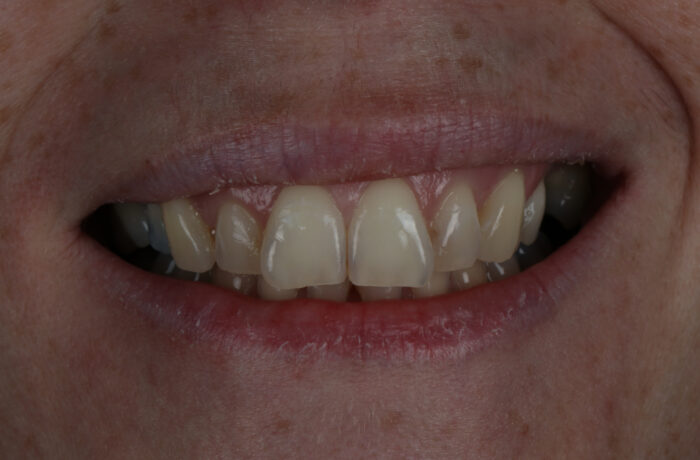 Before - Cheadle Hulme Dental