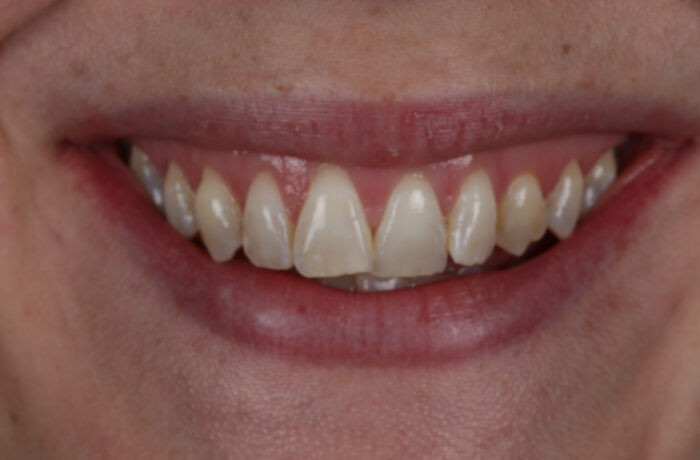 Before - Cheadle Hulme Dental