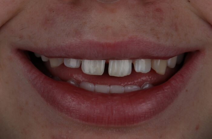 Before - Cheadle Hulme Dental