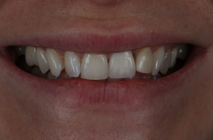 Before - Cheadle Hulme Dental