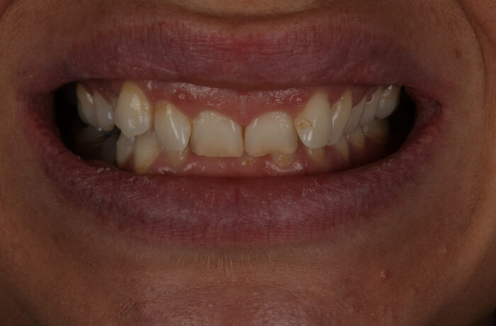 Before - Cheadle Hulme Dental