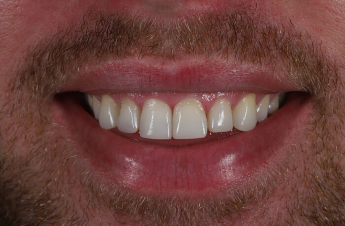 After - Cheadle Hulme Dental