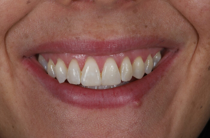 After - Cheadle Hulme Dental