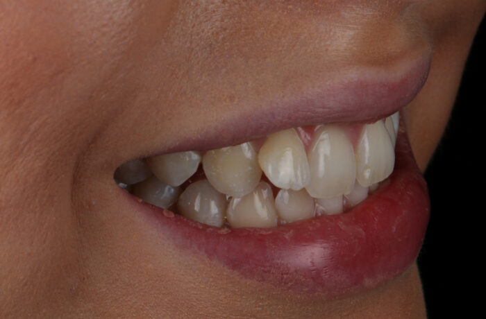 Before - Cheadle Hulme Dental