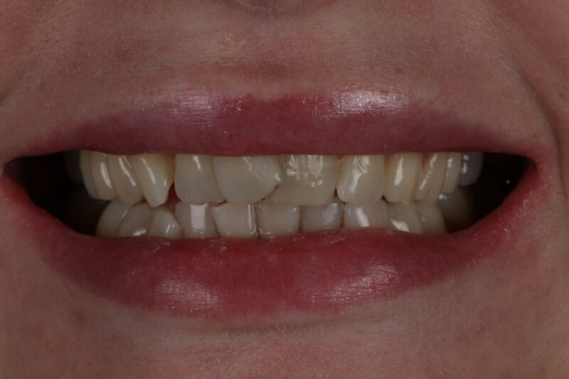 Before - Cheadle Hulme Dental