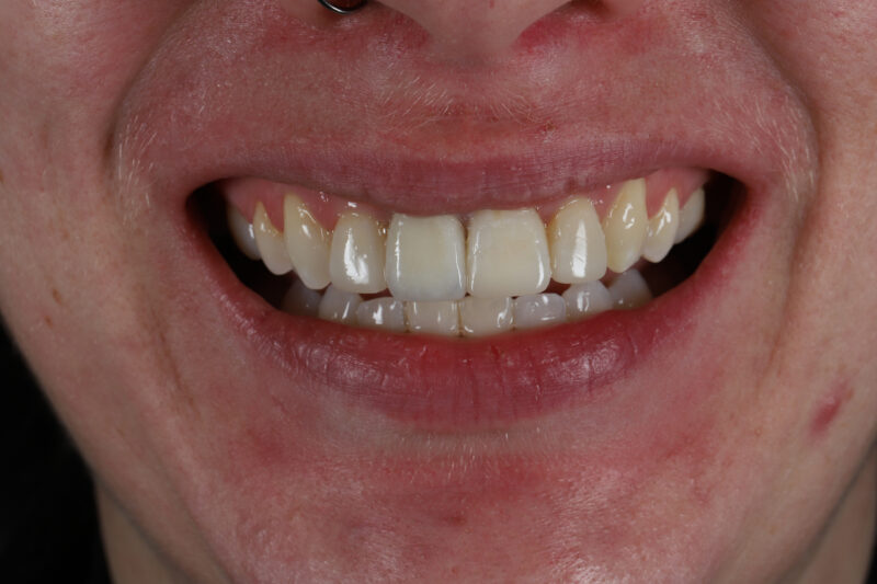 After - Cheadle Hulme Dental