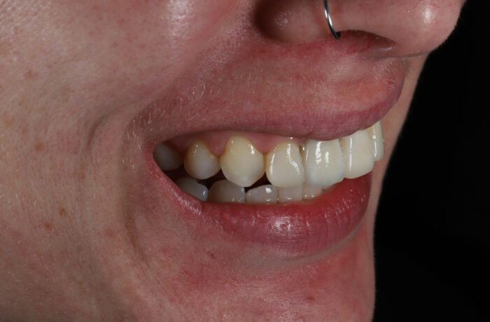 After - Cheadle Hulme Dental