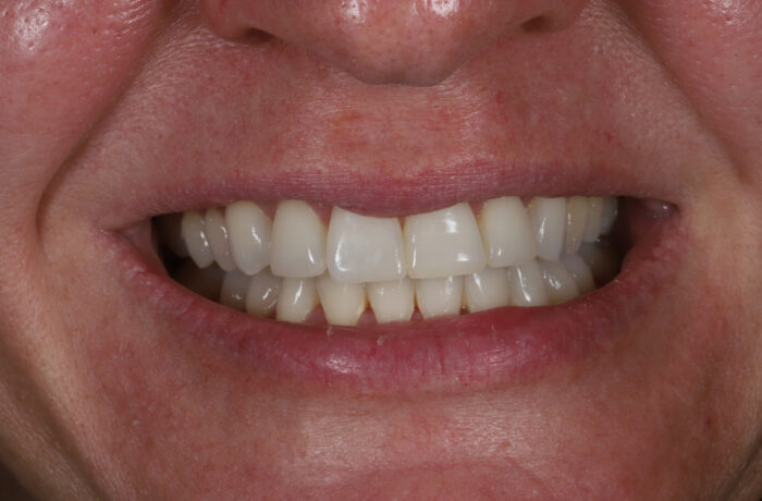 After - Cheadle Hulme Dental