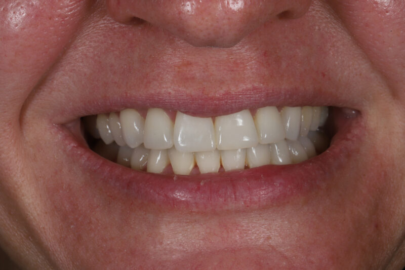 After - Cheadle Hulme Dental