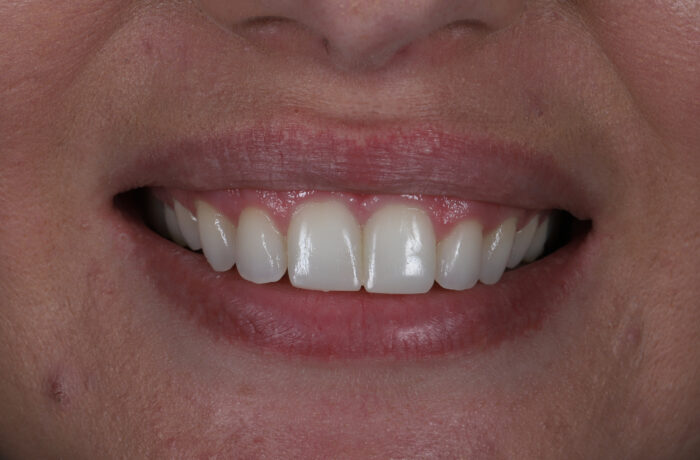 After - Cheadle Hulme Dental