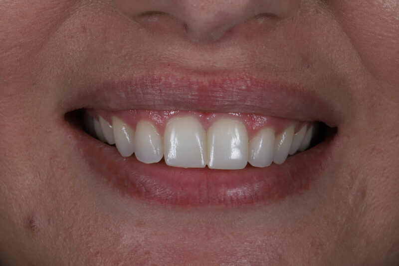 After - Cheadle Hulme Dental