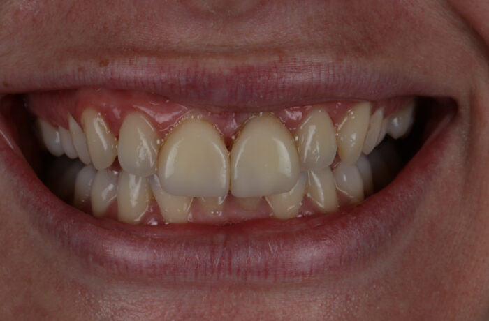 Before - Cheadle Hulme Dental