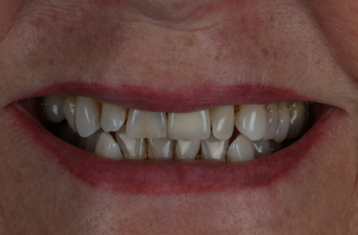 Before - Cheadle Hulme Dental