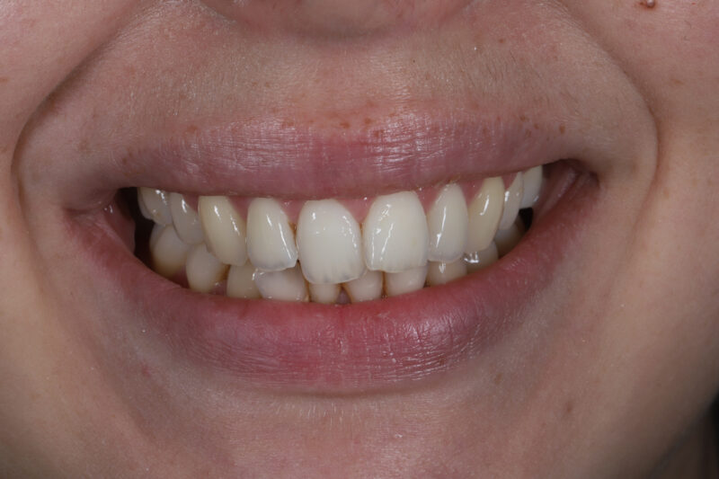 Before - Cheadle Hulme Dental