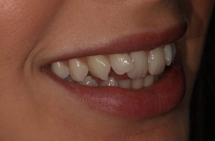 Before - Cheadle Hulme Dental