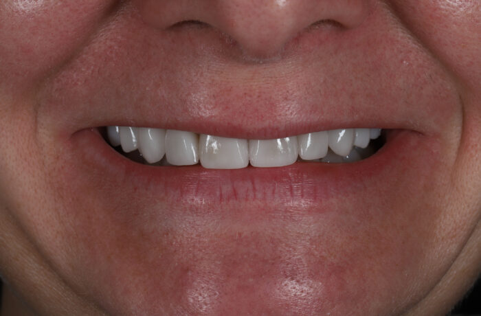 After - Cheadle Hulme Dental